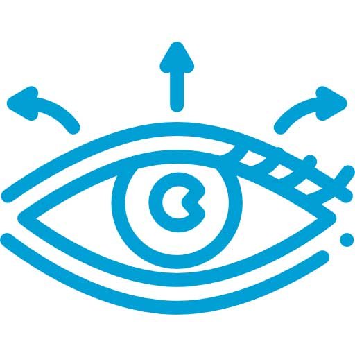 CIRUGIA PARA QUERATOCONO